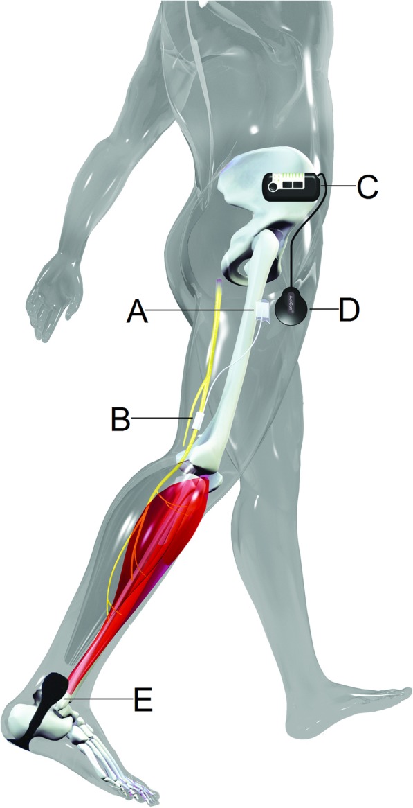 Fig. 2