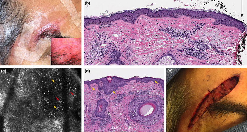 Figure 3: