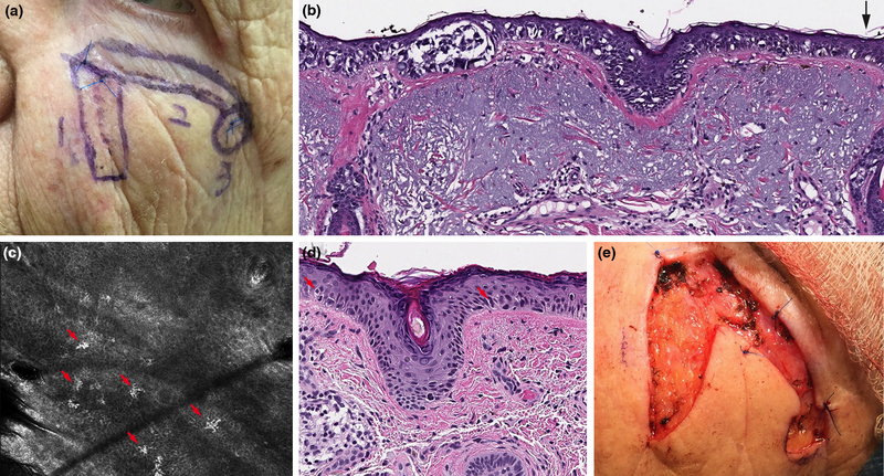 Figure 2: