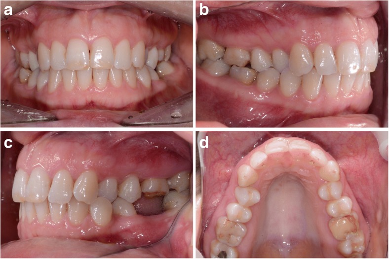 Fig. 1