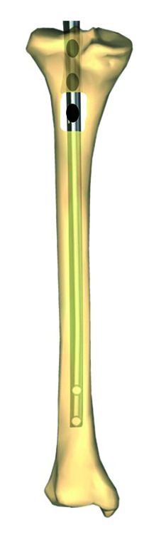 Fig. 5