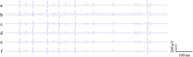 Fig. 2