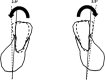 Figure 6. Lower increase molar angulation between T0 and T2.