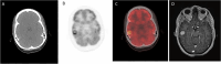 Fig. 1.