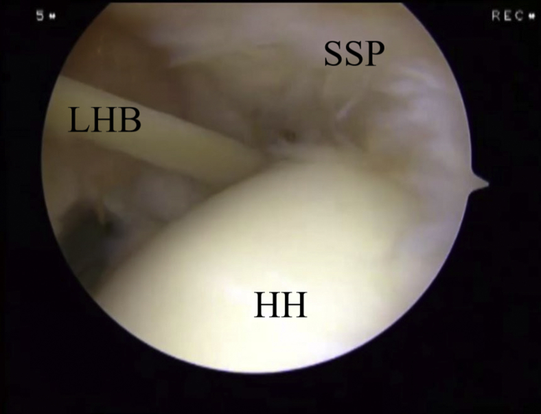 Fig 10