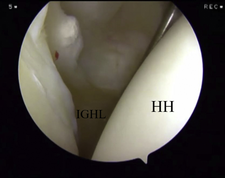 Fig 6