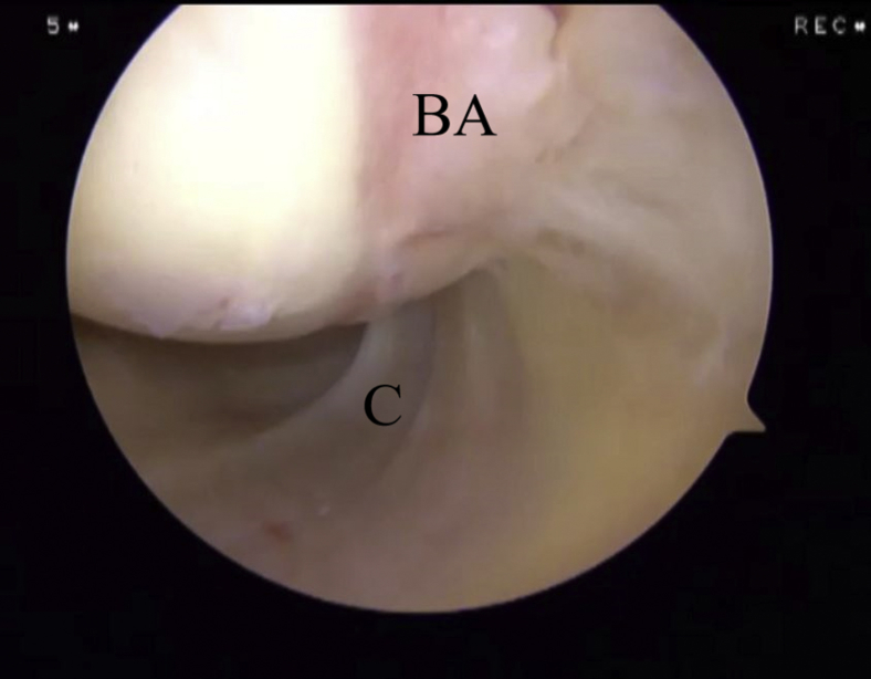 Fig 13