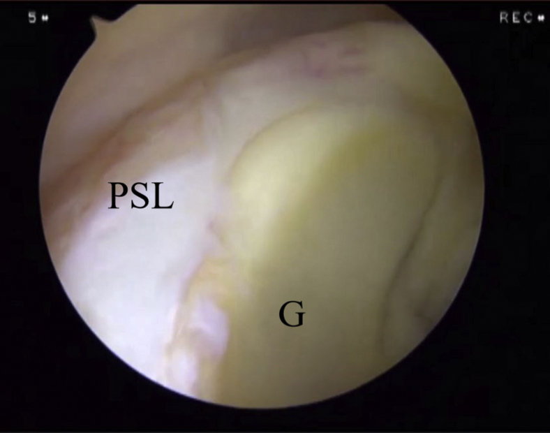 Fig 9