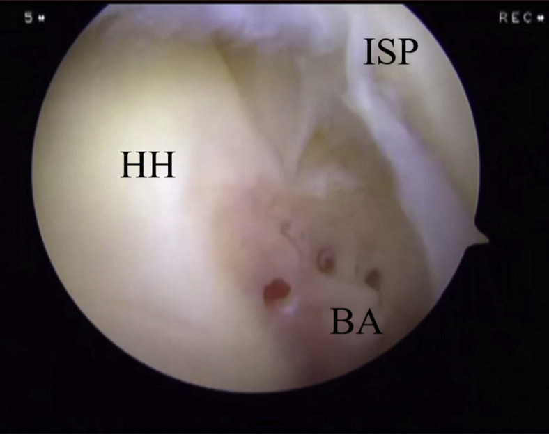 Fig 11
