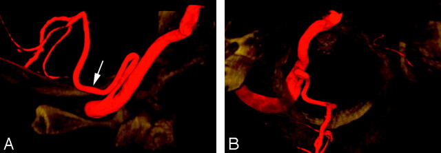 Fig 3.