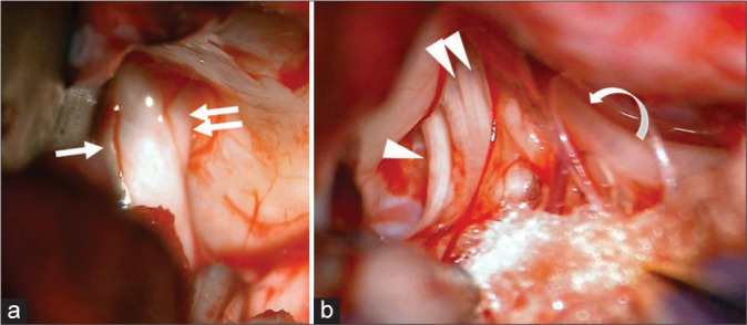 Figure 3: