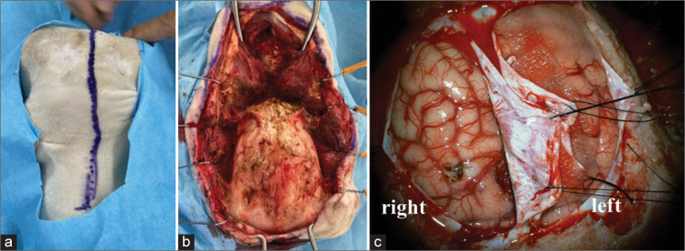 Figure 1: