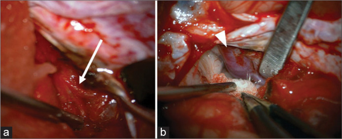 Figure 2: