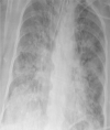 Fig. 11