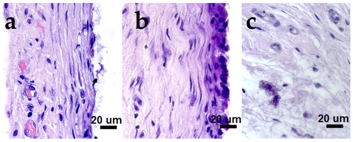 Figure 15