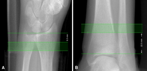 Fig. 4A–B