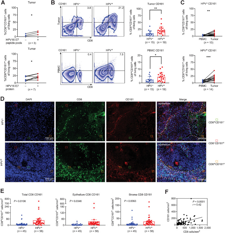 Figure 3. The abundance and distribution of CD161 in HPV16-positive OPSCC. A, Frequencies of CD161 on CTL subsets from HPV16-positive tumors after response to HPV16 E7 peptide pools (n = 3) or recombinant oncoprotein E7 (n = 7) via flow cytometry, paired Student t test. B, Flow cytometry for expression of CD161 on CTLs in tumors and PBMCs (HPV−, n = 15; HPV+, n = 19), unpaired Student t test. C, Pairwise proportion of CD161+ CTLs in tumors and matched PBMCs (HPV−, n = 13; HPV+, n = 14), paired Student t test. D, Representative images of epithelial and stromal sites. The densities of CD8+ T cells and CD161+ cells were counted in HPV− (n = 45) and HPV+ (n = 38) OPSCC biopsies by immunofluorescence. E, The density of total CD161+ CTLs in the epithelium and stroma for each patient. F, Correlation analysis between the number of total CD8+ T cells and total CD161+ cells. *, P < 0.05; **, P < 0.01; ***, P < 0.001.