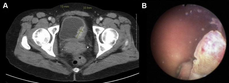 Figure 1