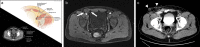 Fig. 12