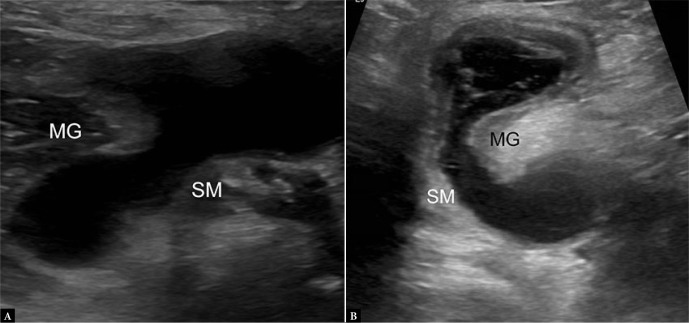 Fig. 17.