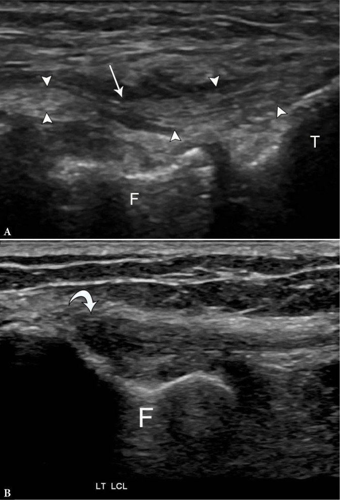 Fig. 10.