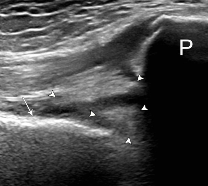 Fig. 14.