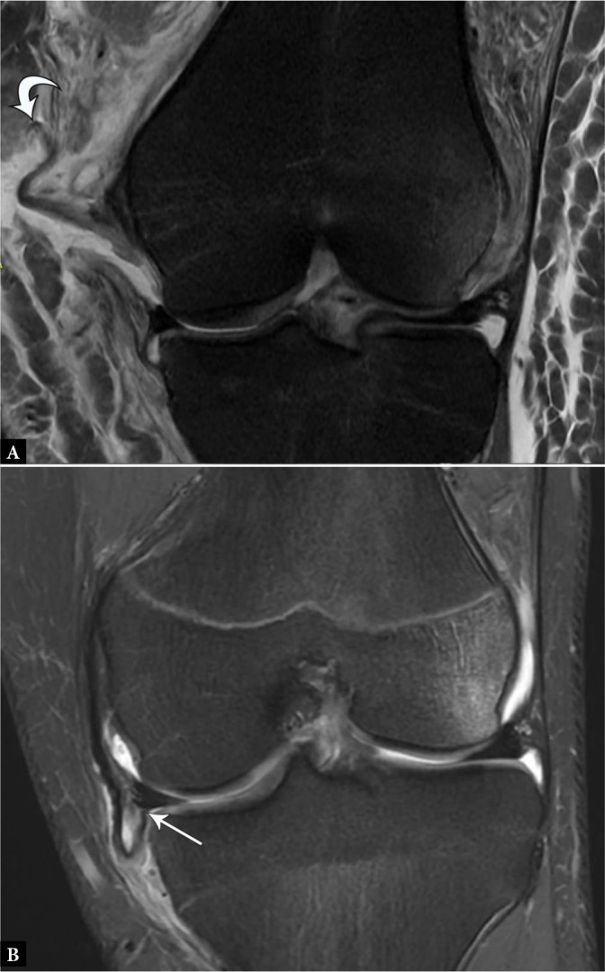 Fig. 11.