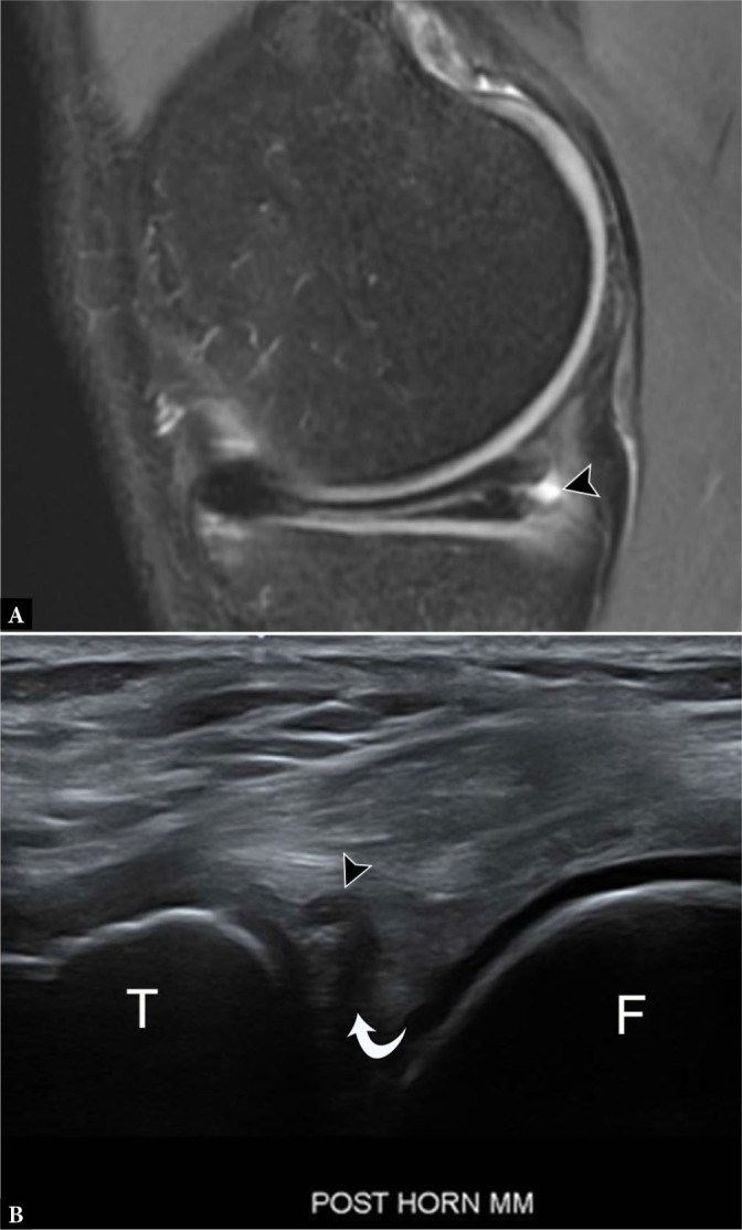 Fig. 12.