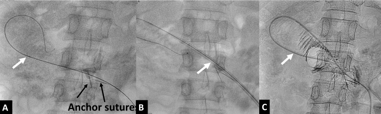 Figure 13.