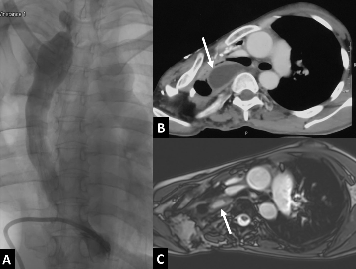Figure 12.