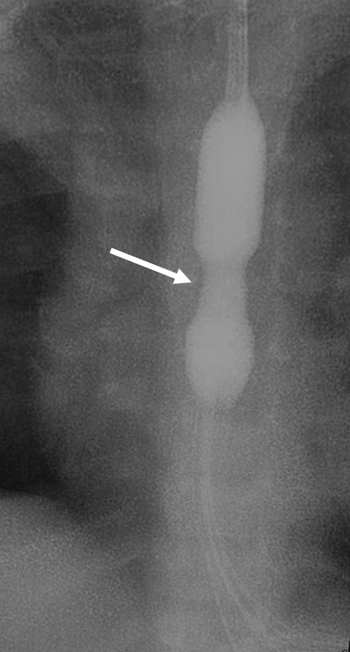 Figure 11.