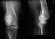 Figure 2AB.