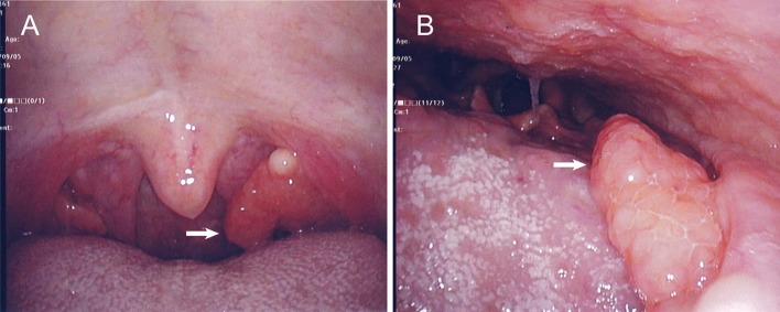 Fig. 1