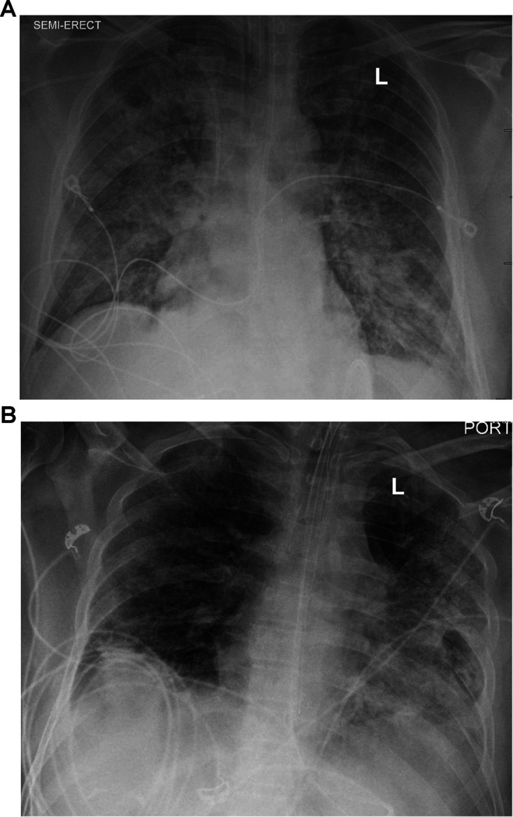 FIG 1