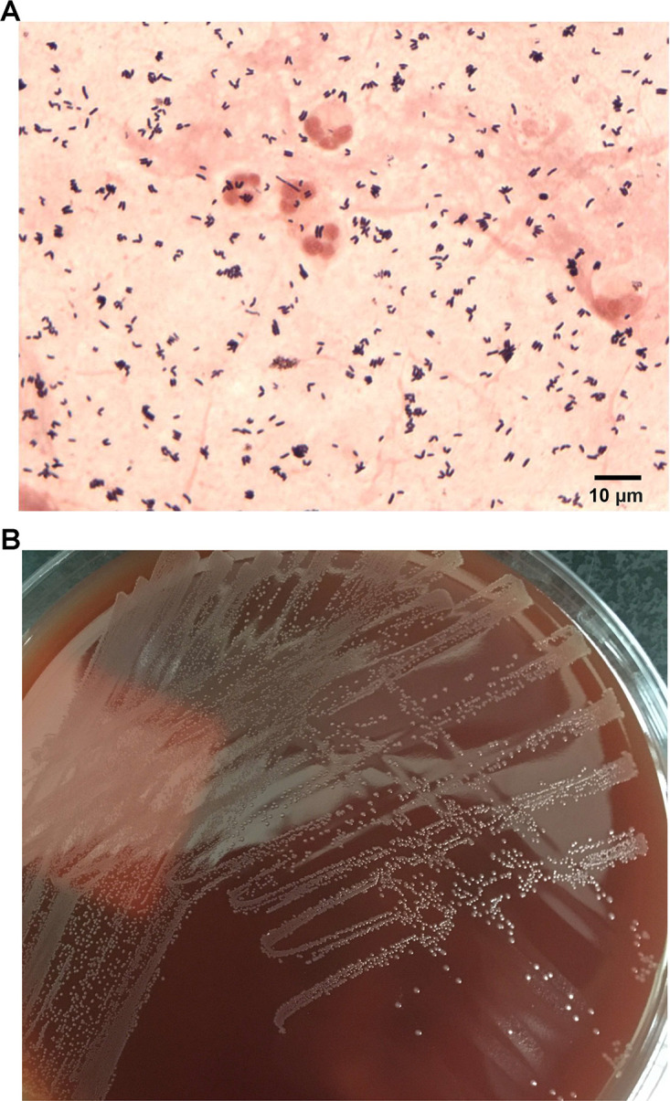 FIG 2