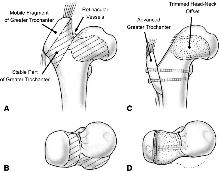 Fig. 2A–D