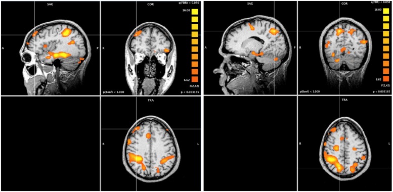 FIGURE 3