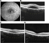 Fig.4