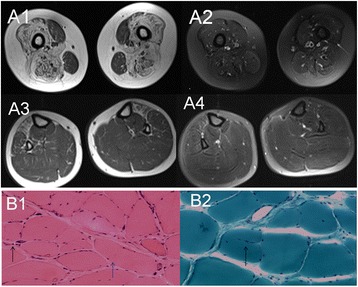 Fig. 4