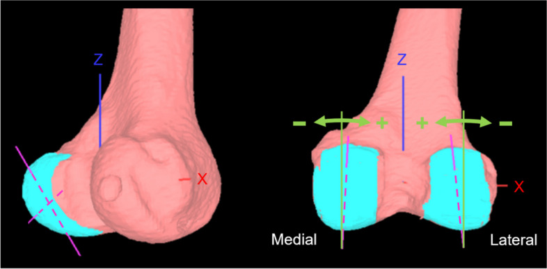Fig. 2