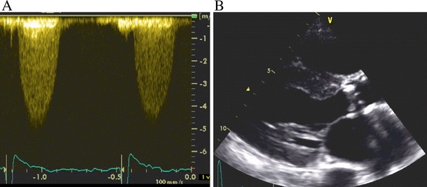 Fig. 1