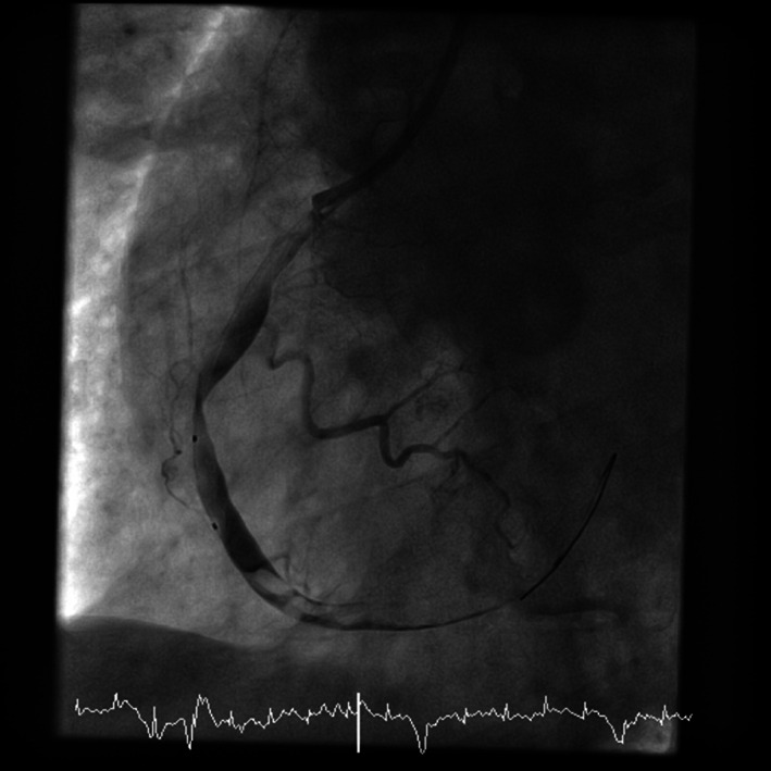 FIGURE 2