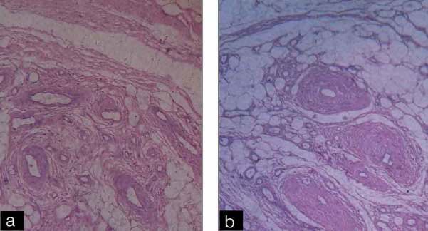 [Table/Fig-6]: