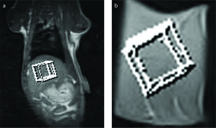 Figure 2 a, b.