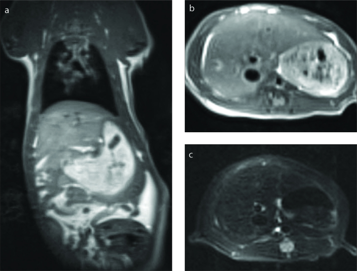 Figure 1 a–c.