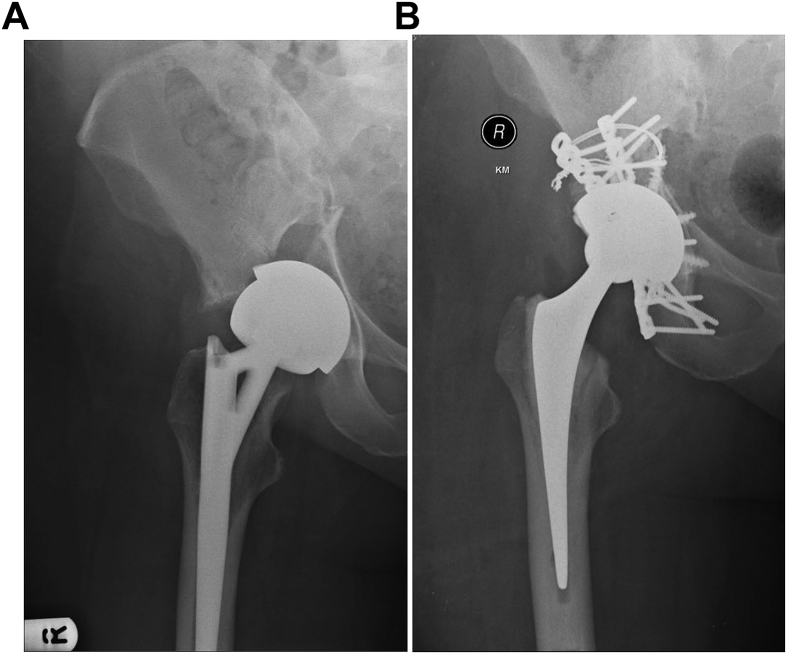 Fig. 4