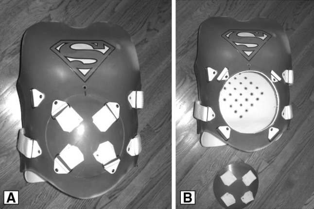 Fig. 1A–B