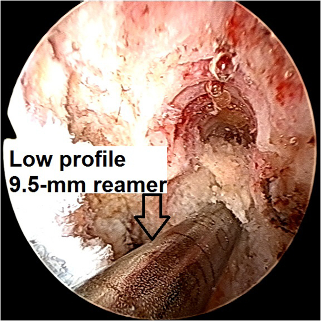 Fig 15