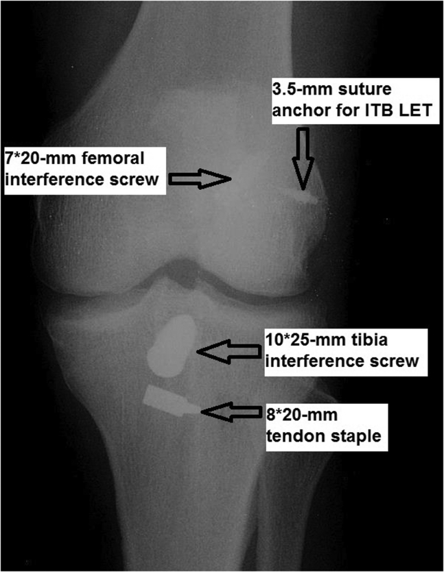 Fig 26