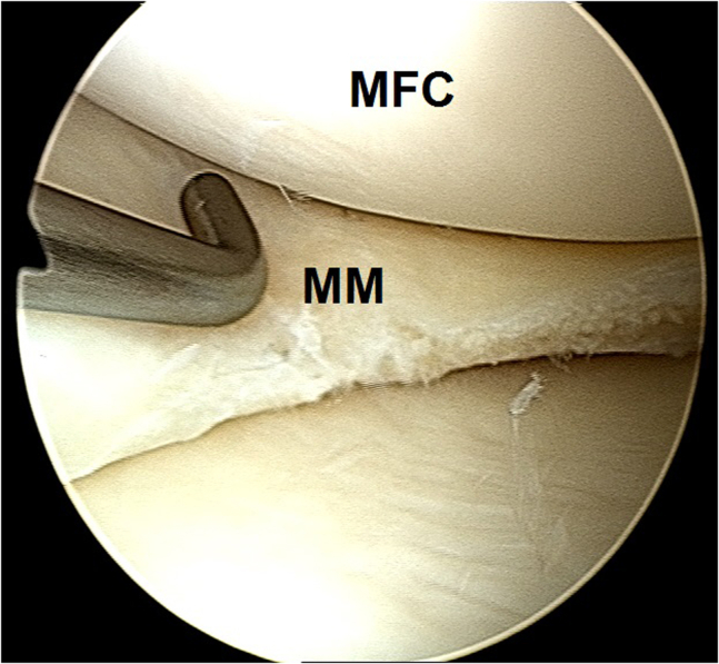 Fig 9